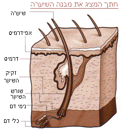 הסרת שיער בלייזר